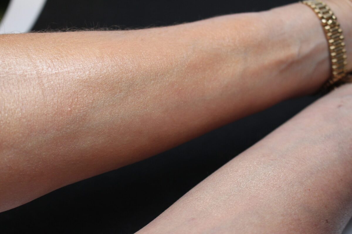 left arm with Jouer, right arm without, and you see what I mean by a big luminizing , healthy difference!