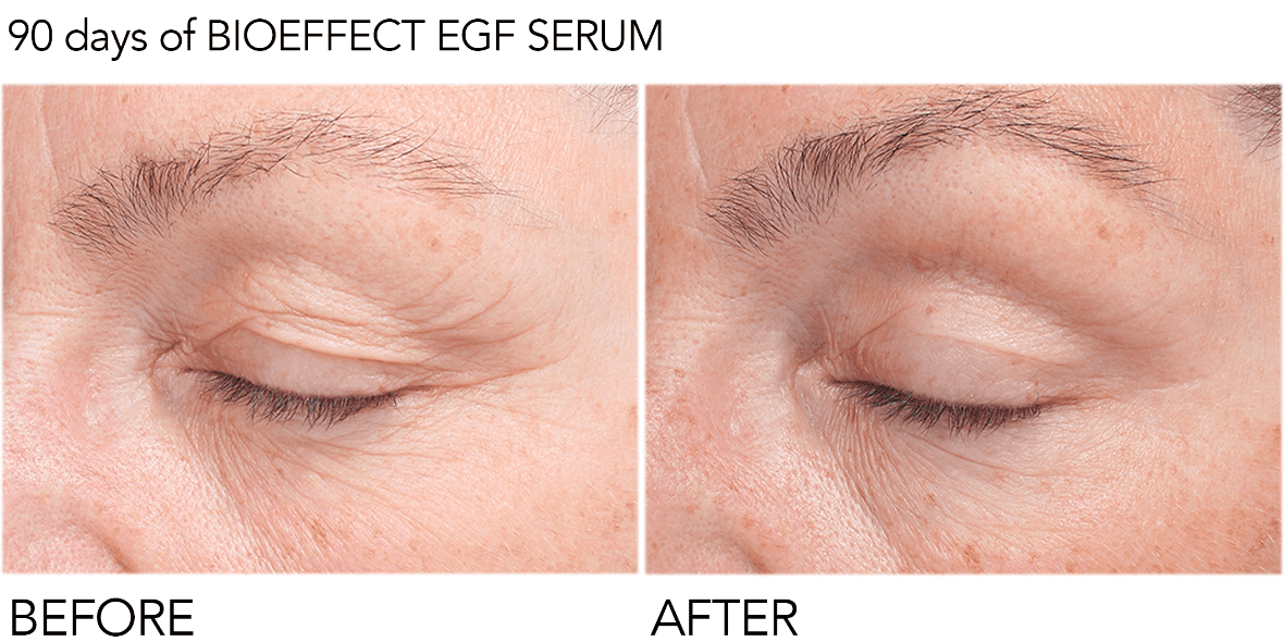 before and after being treated with EGF