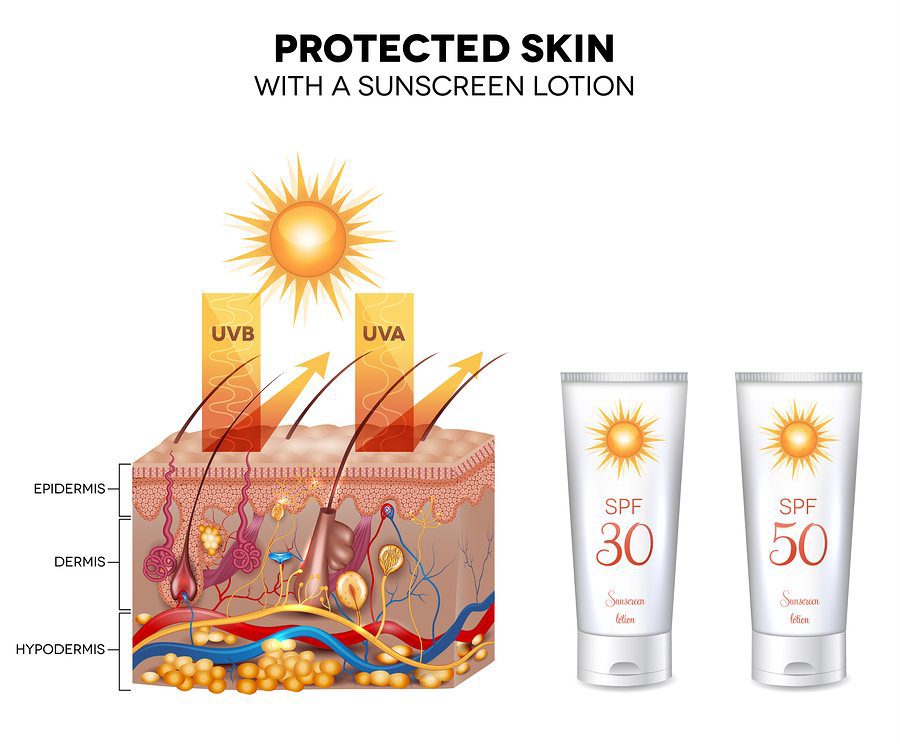 Protected skin with a sunscreen lotion UVB and UVA rays can not penetrate into the skin. Sunscreen lotion bottle with SPF 50 very high protection.