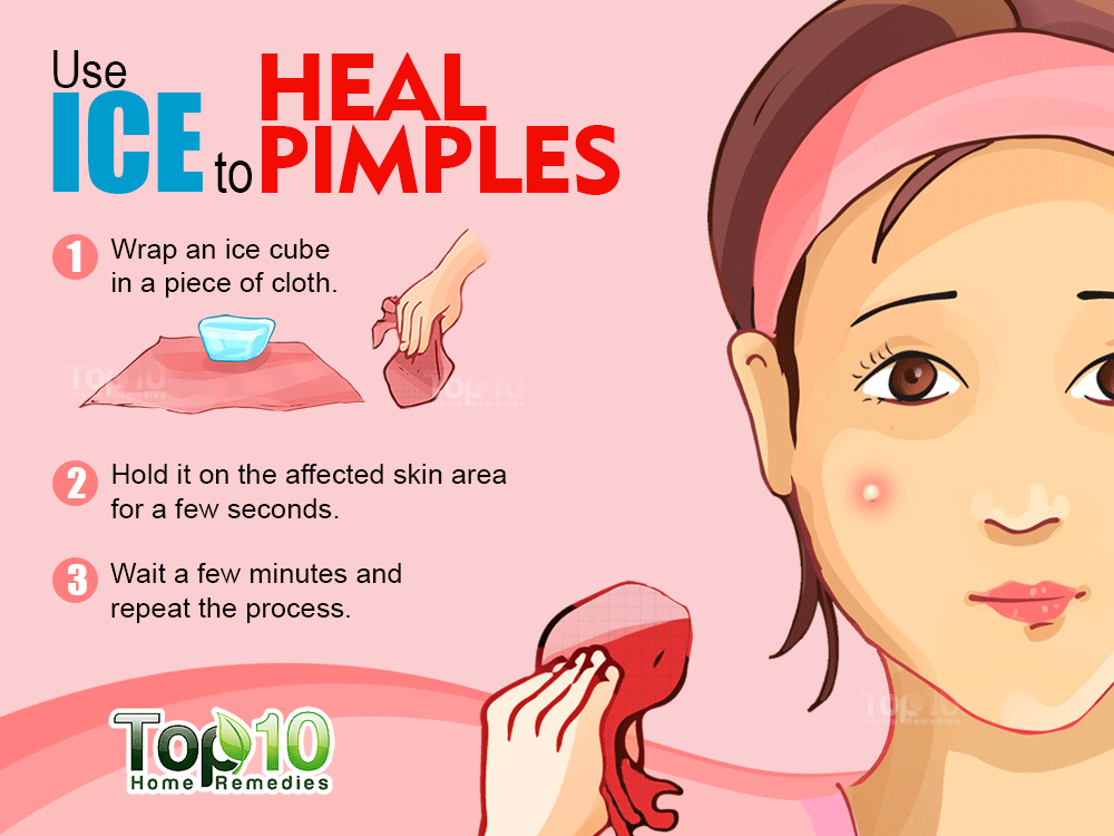 Icing-skin-icing-can-heal-pimples-quickly-and-easily-and-prevent-pimples