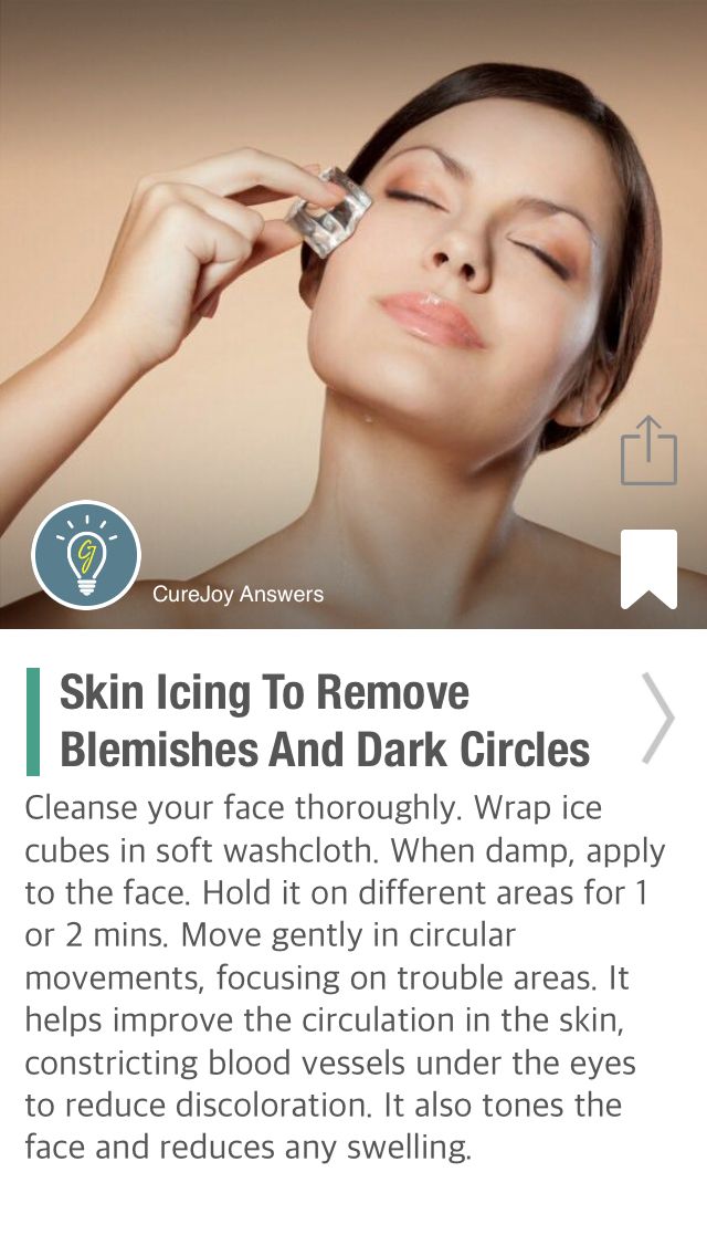 Icing-skinicing-removes-dark-circles