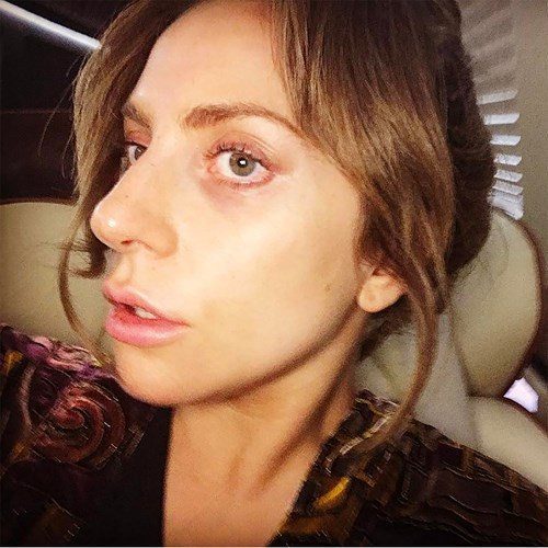 Again, Lady Gaga with no makeup