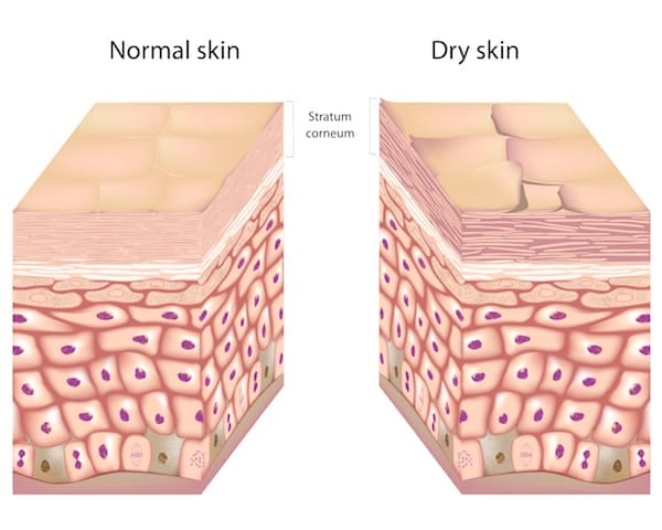 moisturize flaky dry skin, do not exfoliate